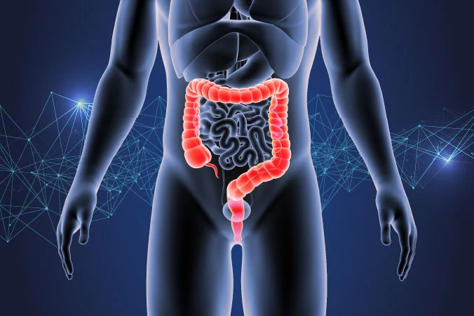 Medical illustration of the colon for colorectal cancer article